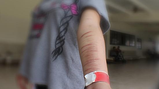 CCJ derruba veto às medidas de prevenção à depressão, automutilação e suicídio