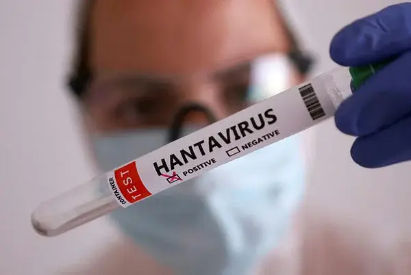 🐭 Santa Catarina confirma primeiro caso de hantavirose de 2026 em Seara