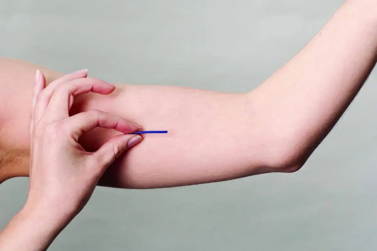 🩺 Saúde de Braço do Norte inicia oferta gratuita de implante contraceptivo