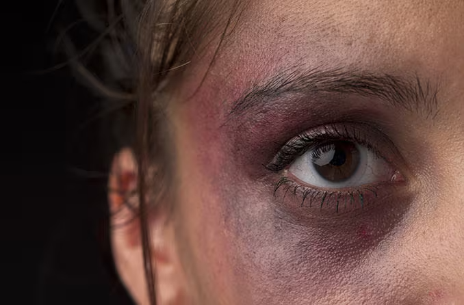 Homem é preso após agredir companheira com socos no rosto em Forquilhinha