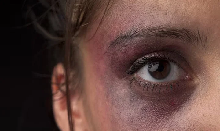 Homem é preso após agredir companheira com socos no rosto em Forquilhinha